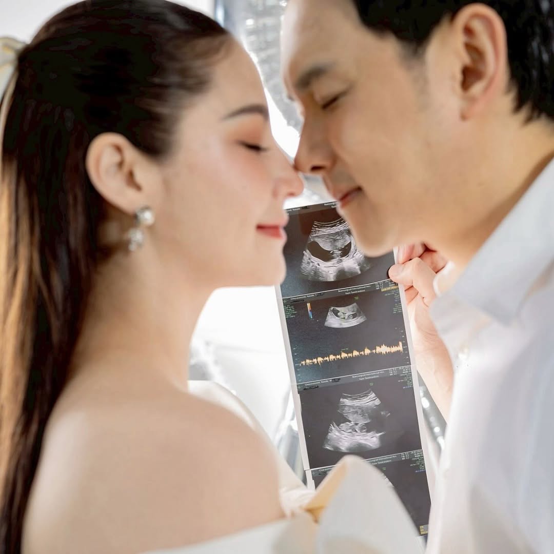 นาตาลี และ ฟลุค