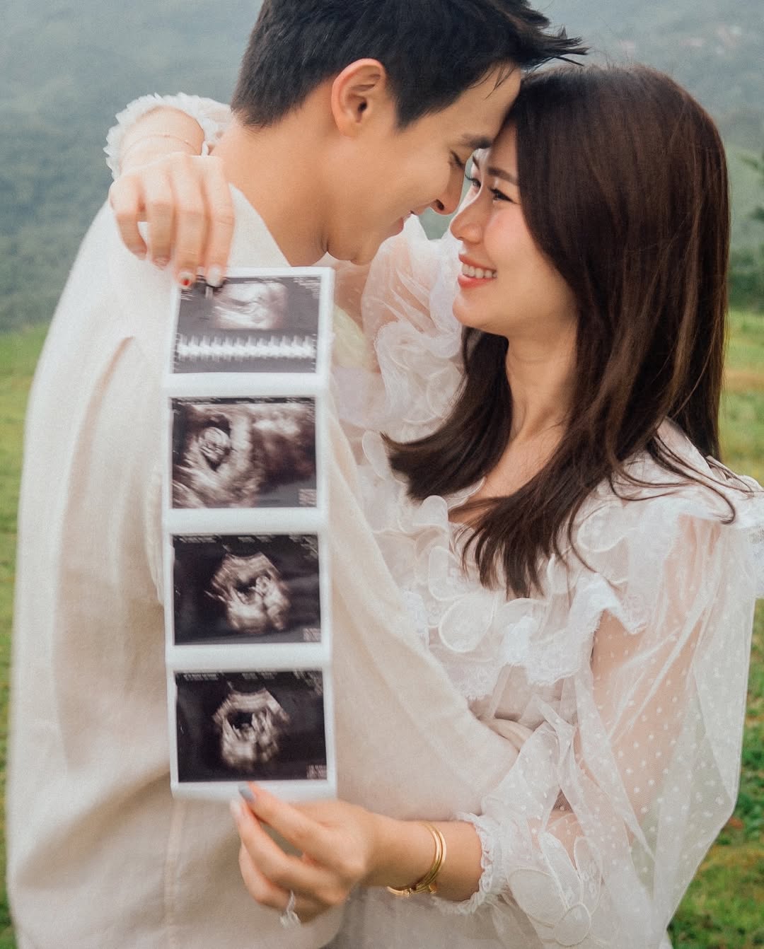 เจมส์ จิรายุ และ โฟมเปิดภาพอัลตราซาวด์