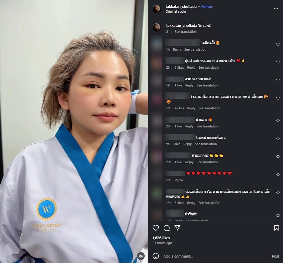 ตั๊กแตน ชลดา เปิดหน้าใหม่ครั้งแรกหลังตัดไหม