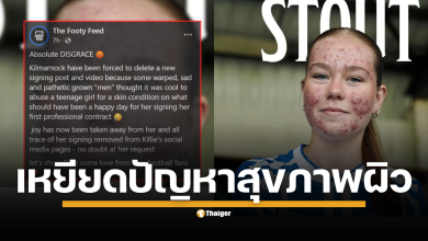 กลายเป็นเรื่องราวที่สร้างความขุ่นเคืองและสะท้อนด้านมืดของโลกออนไลน์ เมื่อสโมสรฟุตบอลหญิง คิลมาร์น็อค (Kilmarnock FC Women) ในสกอตแลนด์ ถูกบีบให้ลบโพสต์และวิดีโอเปิดตัว &quot;Skye Stout&quot; นักเตะสาวดาวรุ่งคนใหม่ออกจากทุกแพลตฟอร์ม หลังจากที่เธอต้องเผชิญกับการถูกคุกคามและเหยียดหยามเรื่องปัญหาสุขภาพผิวอย่างรุนแรง