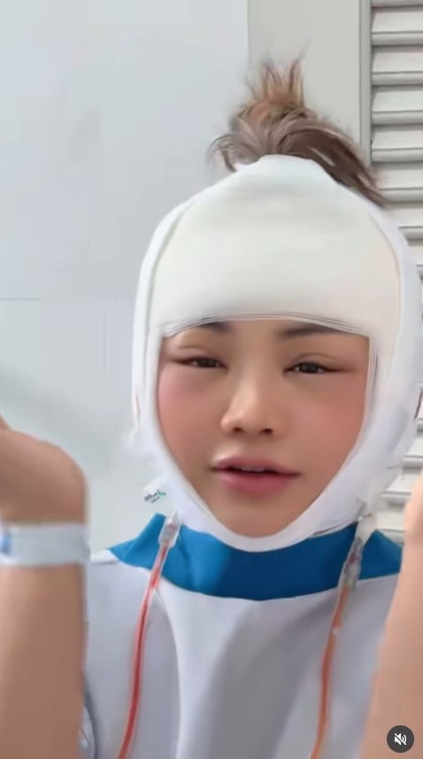 ตั๊กแตน ชลดา ศัลยกรรม สวยขึ้นมาก