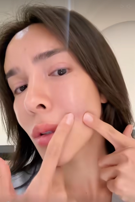 นัท นิสามณี แชร์อุทาหรณ์ ฉีดหน้ากับหมอกระเป๋า สุดท้ายเน่า ต้องเข้าผ่าตัดด่วน-2