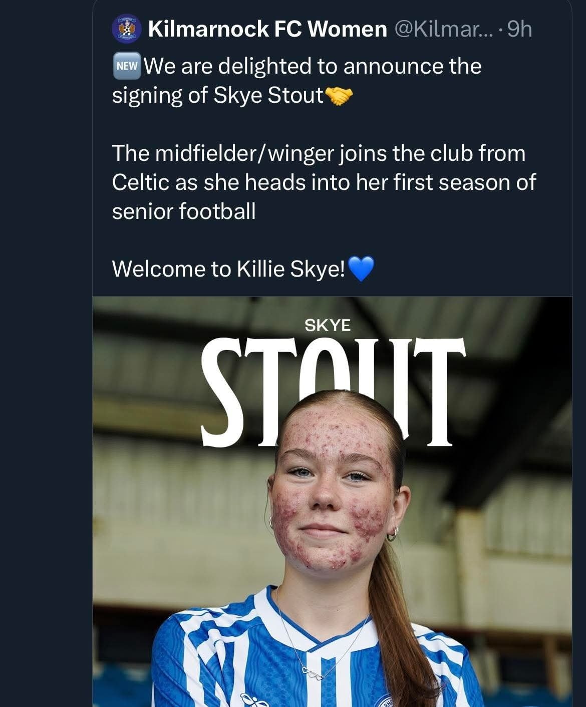 สโมสร Kilmarnock FC Women ต้องลบโพสต์และวิดีโอ