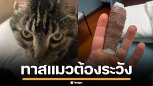 สาวมะกัน โดนแมวข่วนปลายนิ้ว สุดท้ายติดเชื้อหนัก ต้องนอน รพ.ซ้ำโดนถอดเล็บ