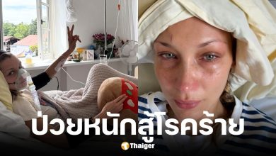 เบลล่า ฮาดิด เปิดภาพสู้โรคลายม์