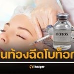 คนท้องฉีดโบท็อกซ์ได้ไหม อยากสวยแต่ลูกต้องปลอดภัย ให้นมบุตรจะปนเปื้อนไหม หมอยืนยันเอง