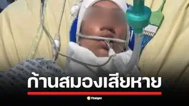 แม่ลูกสองชาวอังกฤษละเมอตกจากระเบียงชั้นสองของที่พัก Airbnb ในปารีสเมื่อวันที่ 26 เมษายน 2567 บาดเจ็บหนักและต้องเข้ารับการรักษาตัวนานกว่า 2 เดือน กำลังทำกายภาพบำบัดเพื่อฟื้นฟูการเคลื่อนไหวและการพูด