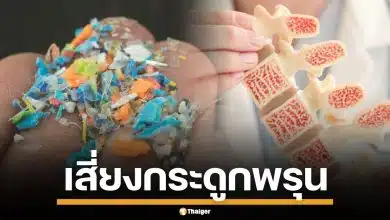 ภัยเงียบ! งานวิจัยชี้ "ไมโครพลาสติก" อาจเป็นสาเหตุใหม่ของ "โรคกระดูกพรุน"