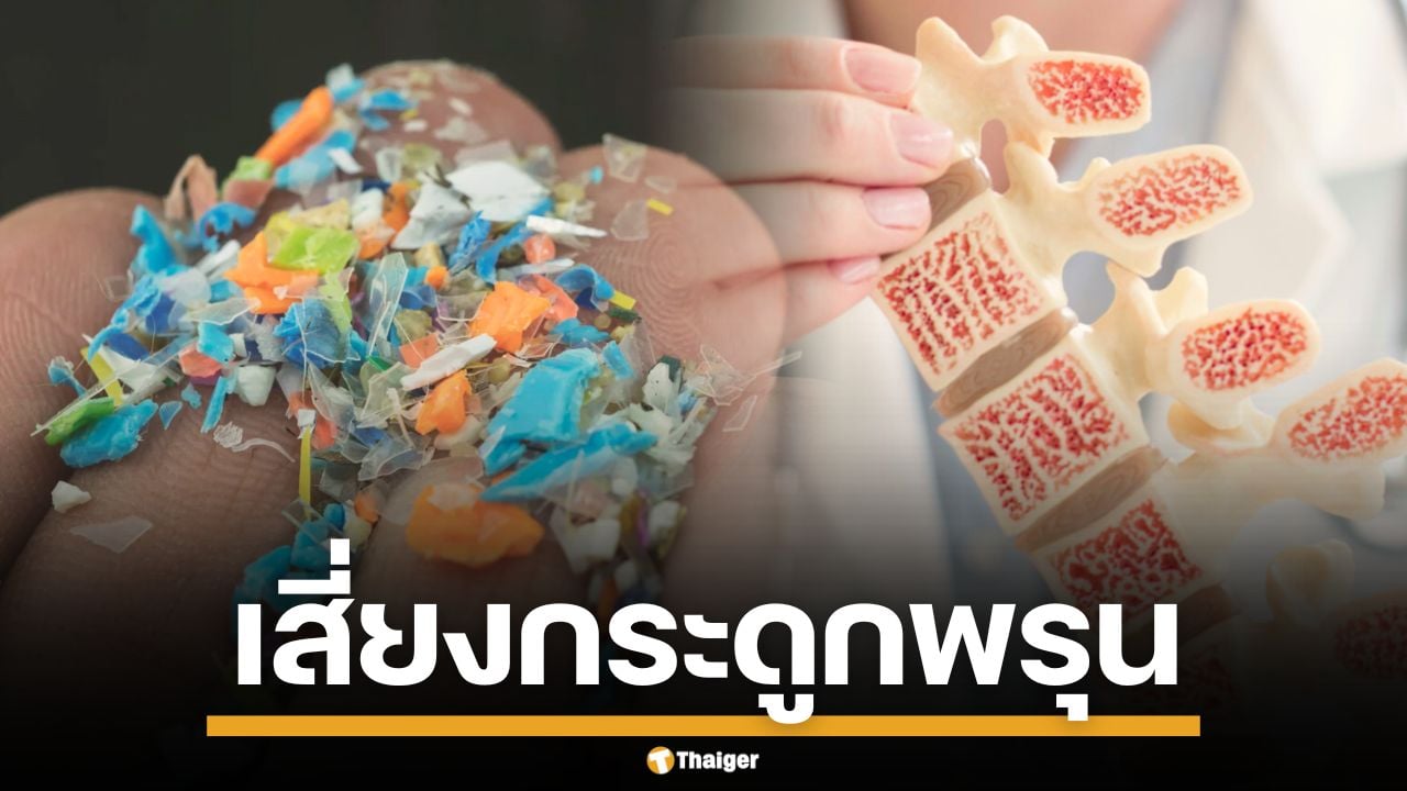 ภัยเงียบ! งานวิจัยชี้ "ไมโครพลาสติก" อาจเป็นสาเหตุใหม่ของ "โรคกระดูกพรุน"