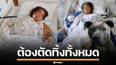 สุดสลด! หญิงมะกันโดน &quot;พิตบูล&quot; ขย้ำปางตาย จนต้องตัดแขนขาทิ้งทั้งหมด