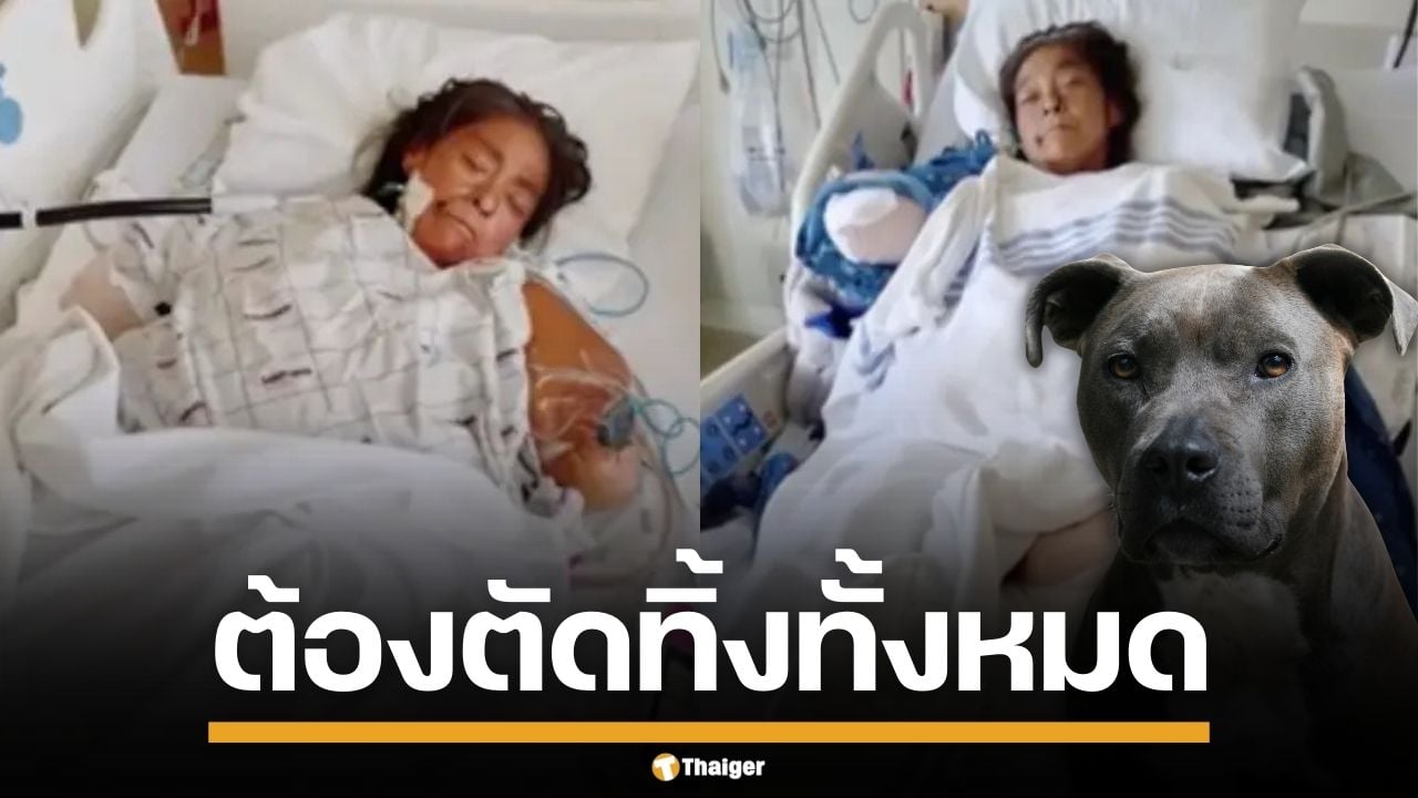 สุดสลด! หญิงมะกันโดน "พิตบูล" ขย้ำปางตาย จนต้องตัดแขนขาทิ้งทั้งหมด