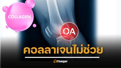 ผลวิจัยล่าสุดชี้ คอลลาเจนไม่ช่วยลดปวดข้อเข่าเสื่อม ข่าวใหญ่การแพทย์ไทย