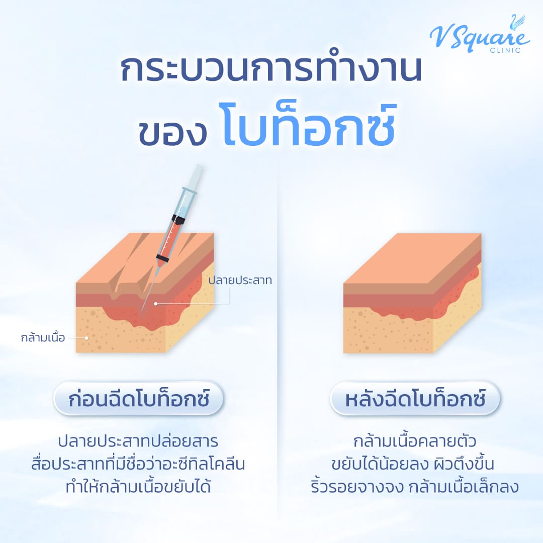 กระบวนการทำงานของโบท็อก