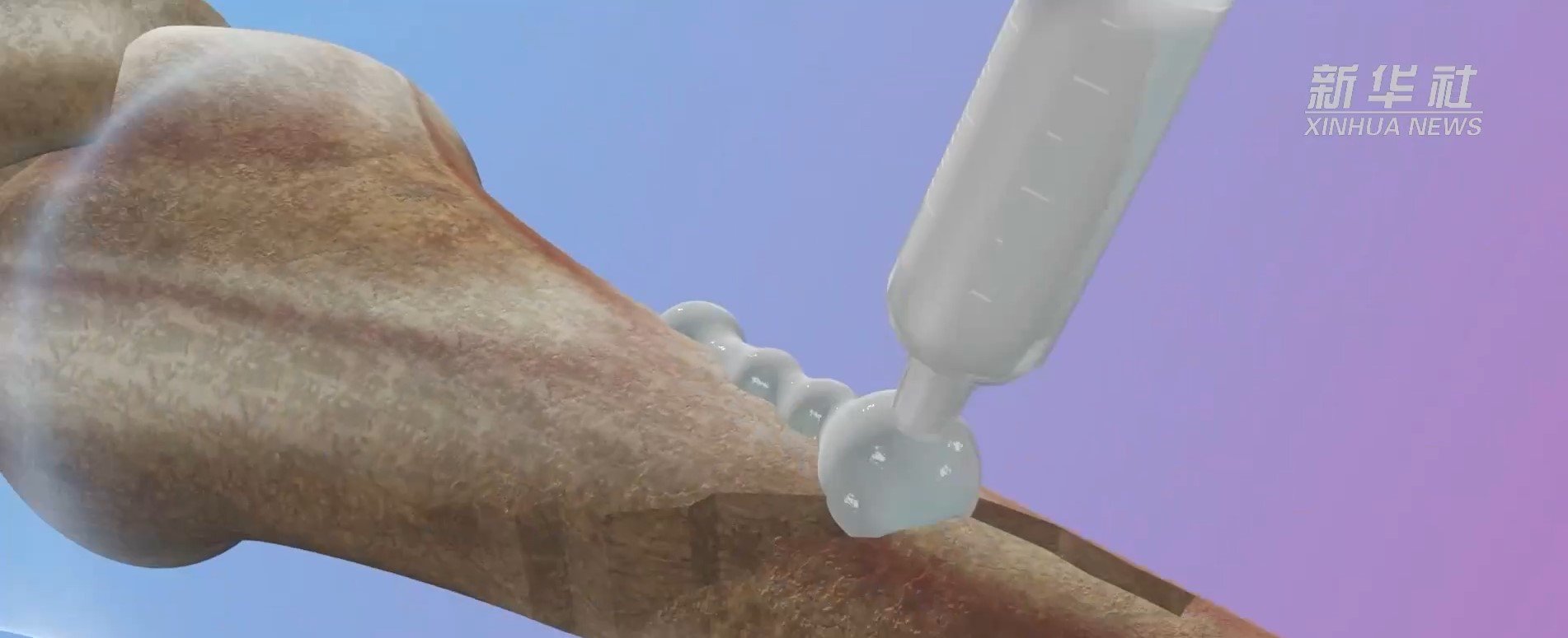 กาวต่อกระดูก