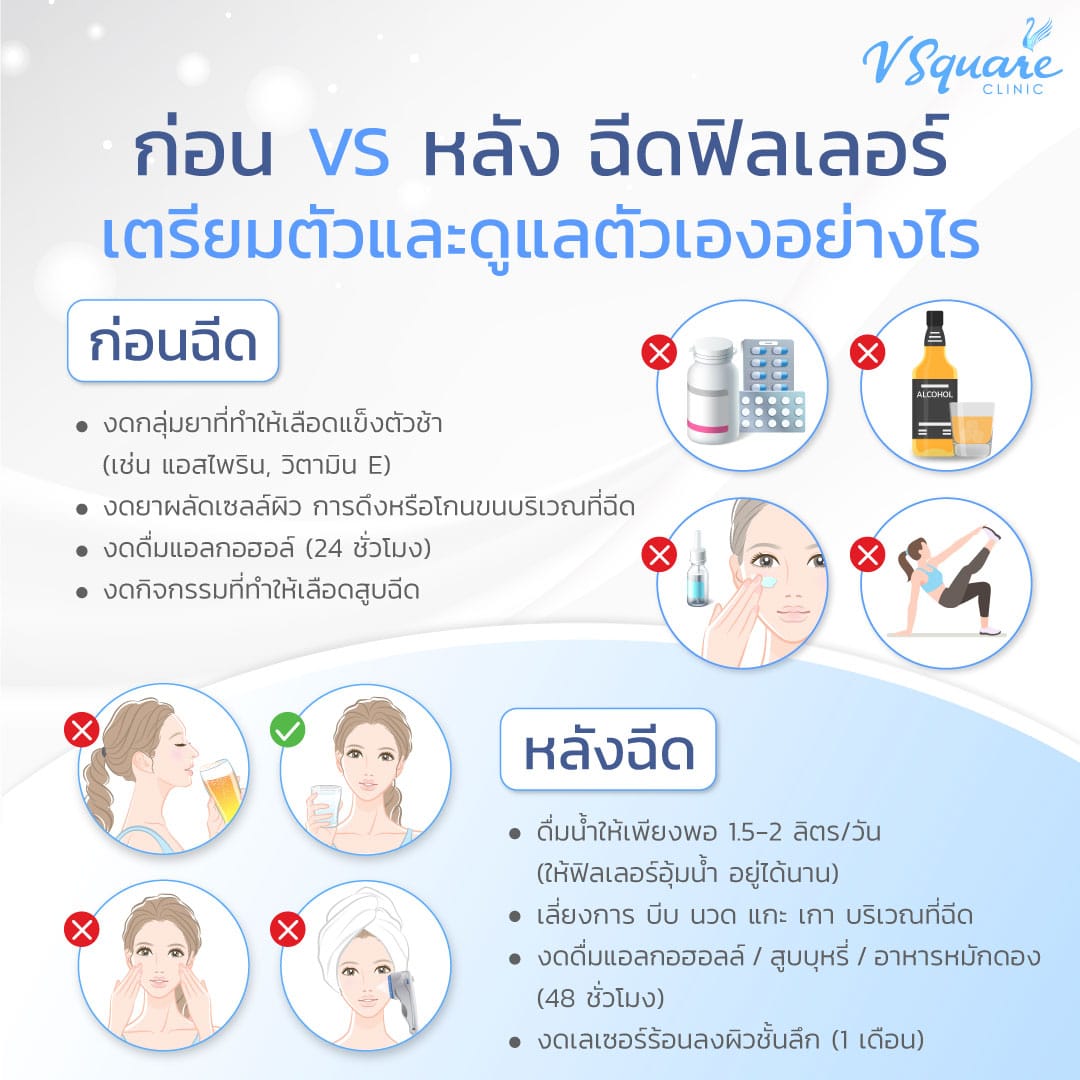 ข้อควรปฏิบัติก่อน-หลังฉีดไฮยาลูรอน