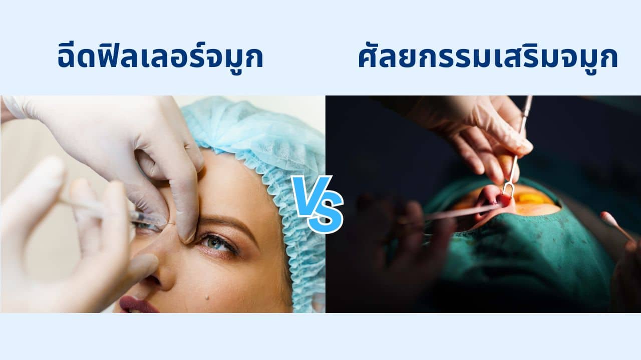 ฉีดฟิลเลอร์จมูก VS ผ่าตัดเสริมจมูก