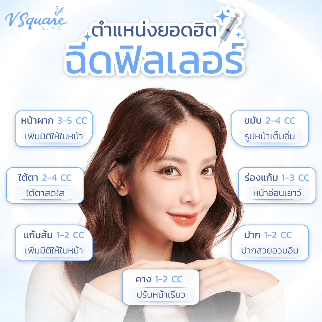 ฉีดฟิลเลอร์ไฮยาลูรอนตำแหน่งไหน