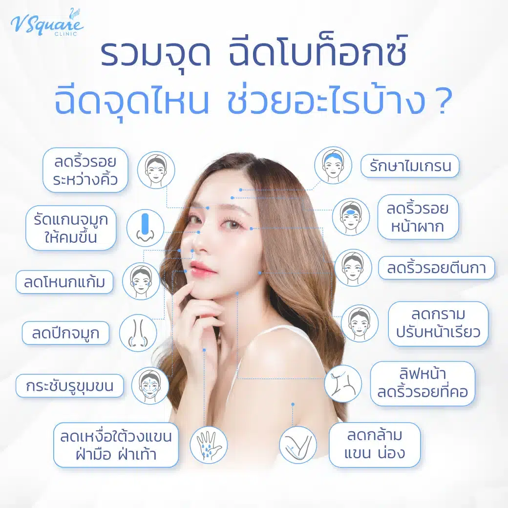 ตำแหน่งฉีดโบท็อก
