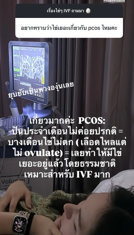 ปันปัน สุทัตตา ฝากไข่ เผยเจ็บจนร้องไห้-ฮอร์โมนทำร้องไห้ตลอด แต่จำนวนที่ได้คุ้มมาก-6