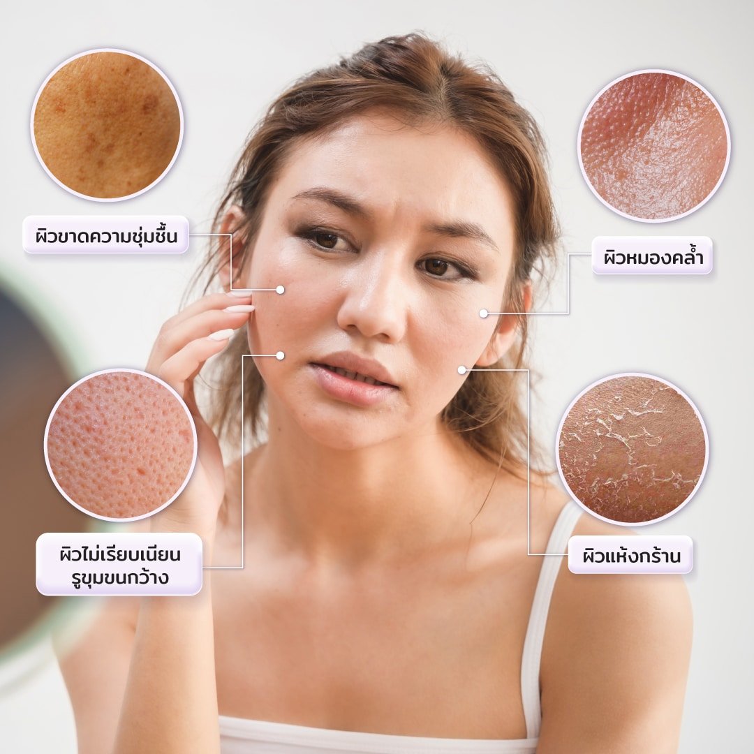 ผิวที่ขาดไฮยาลูรอน