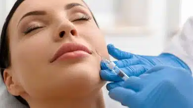 ฟิลเลอร์ร่องแก้ม