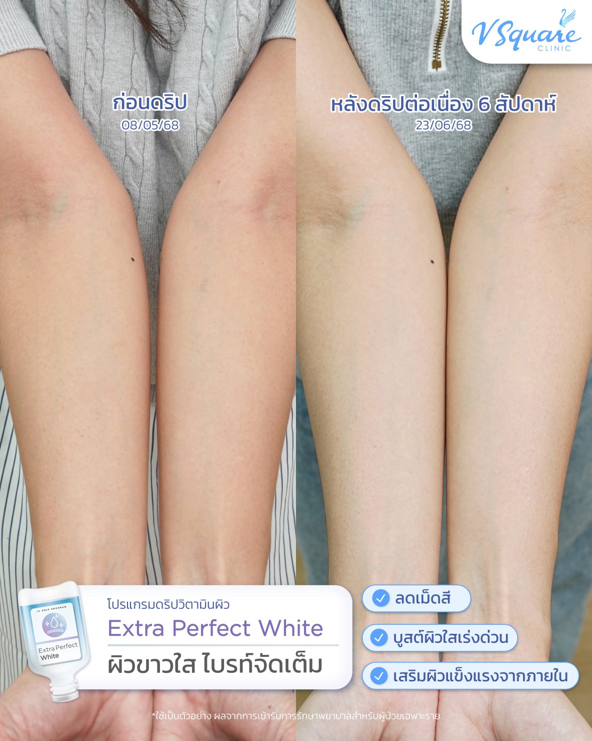 รีวิว Drip Vitamin