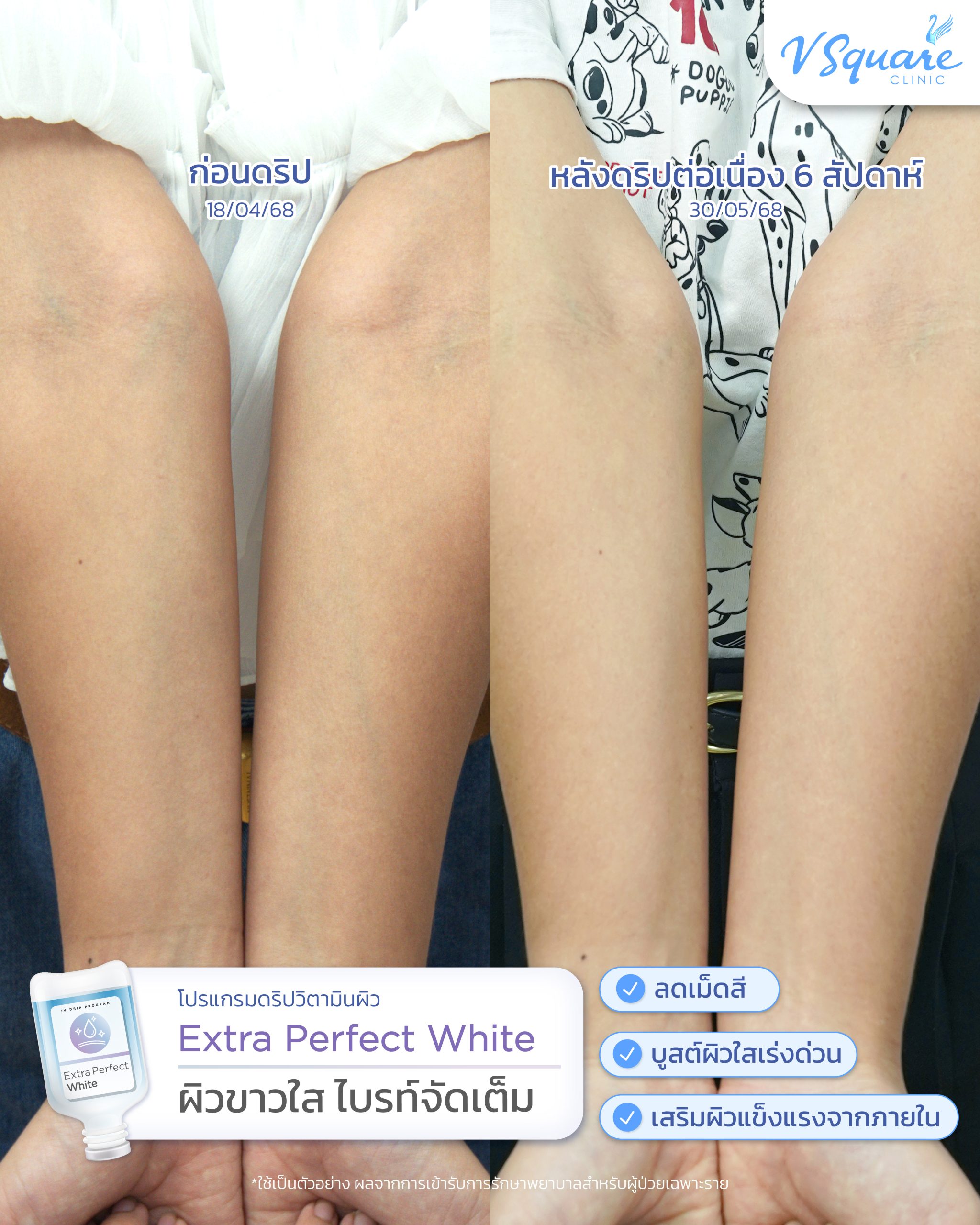 Drip Vitamin รีวิว