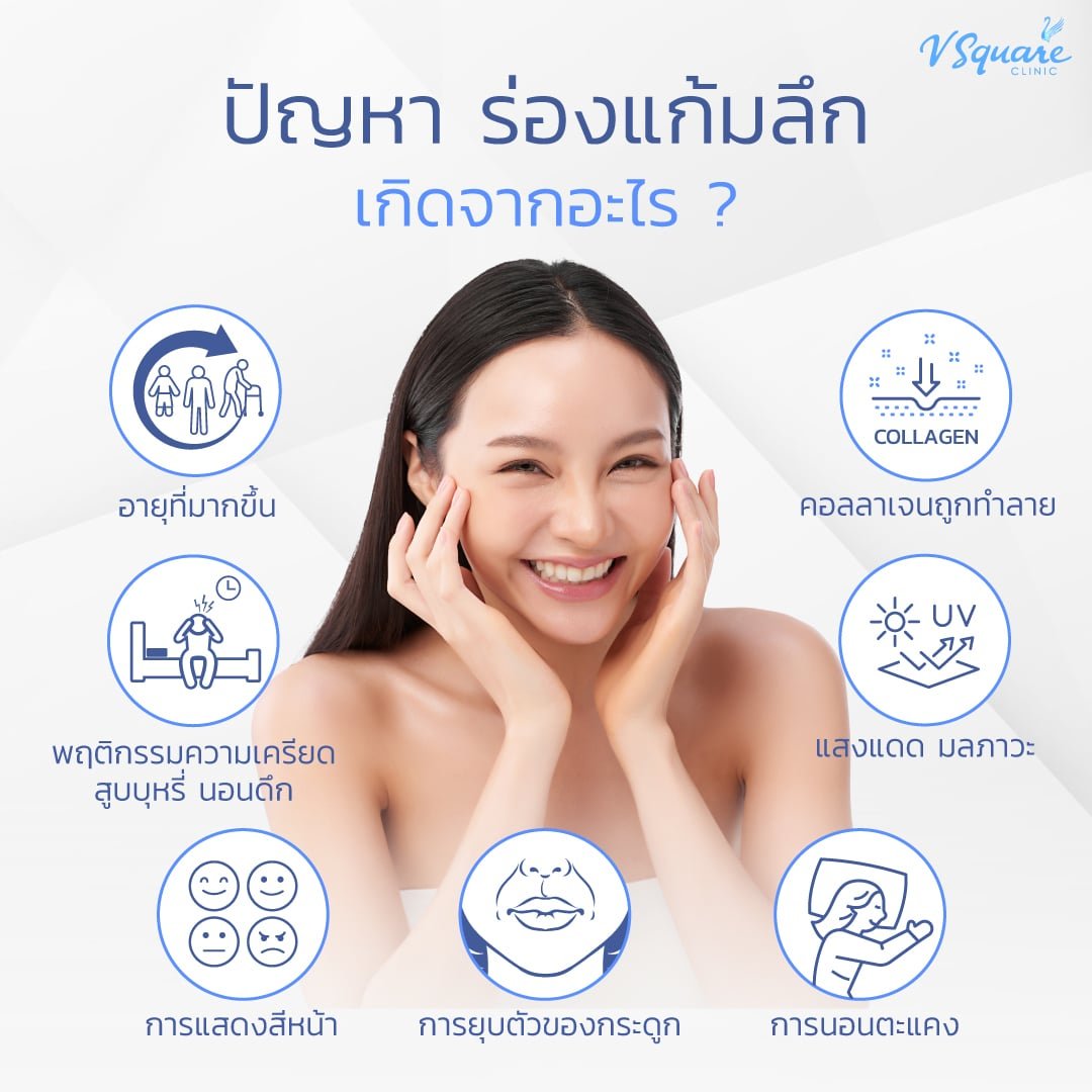 สาเหตุ ร่องแก้มลึก