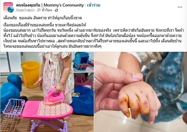 แม่เตือนภัย ลูกถูกเตารีดลวกมือ เพราะคิดว่าเป็นของเล่น ชาวเน็ตจวก ประมาทเอง