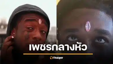 Lil Uzi Vert แร็ปเปอร์สายแฟชั่น ฝังเพชรชมพู 840 ล้านกลางหน้าผาก สุดท้ายโดนกระชากหลุดกลางคอนเสิร์ต