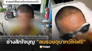 เด็ก 10 ขวบถูกสักหน้า