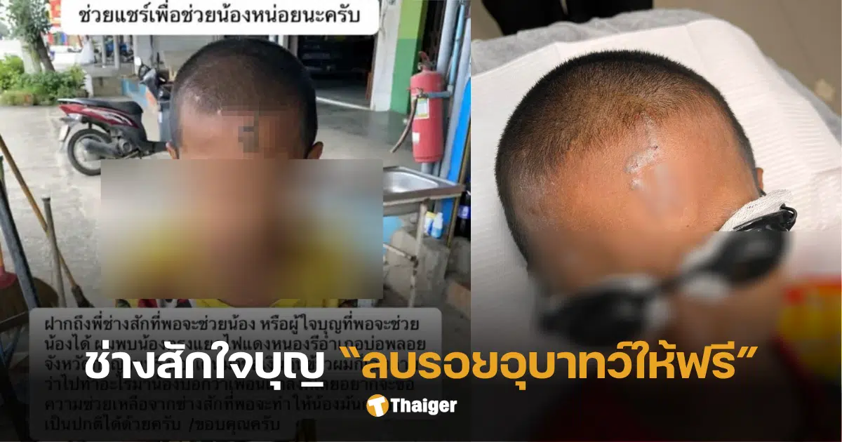 เด็ก 10 ขวบถูกสักหน้า