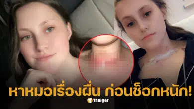 ตรวจเช็กคอ 2568