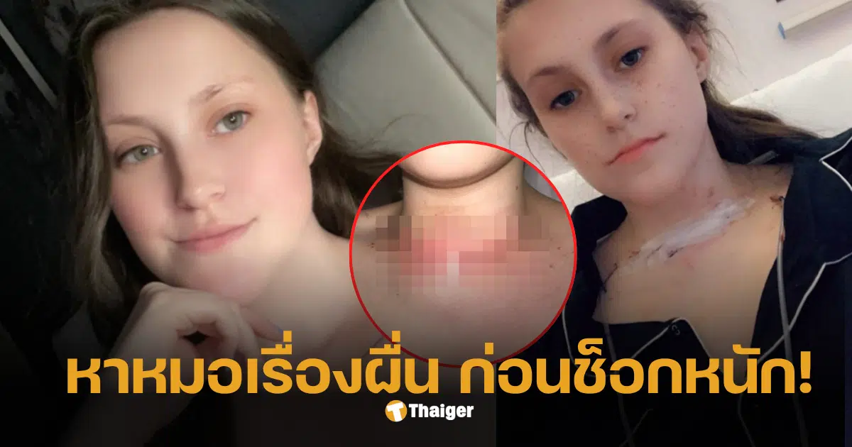 ตรวจเช็กคอ 2568