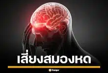 หมอเตือนภัย! นอนน้อย ทำสมองหด เทียบเท่าคนแก่ขึ้น 7 ปี เสี่ยงอัลไซเมอร์