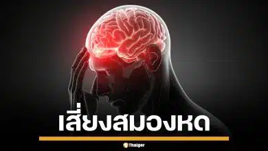 หมอเตือนภัย! นอนน้อย ทำสมองหด เทียบเท่าคนแก่ขึ้น 7 ปี เสี่ยงอัลไซเมอร์