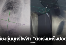 บุหรี่ไฟฟ้า มะเร็งปอด