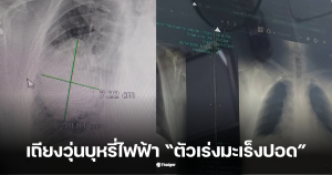 บุหรี่ไฟฟ้า มะเร็งปอด