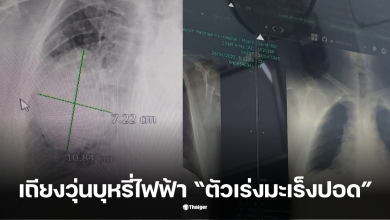 บุหรี่ไฟฟ้า มะเร็งปอด