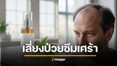 งานวิจัยชี้ "ฟิแนสเทอไรด์" ยารักษาผมร่วงที่คนใช้ทั่วโลก เสี่ยงซึมเศร้า-คิดสั้น