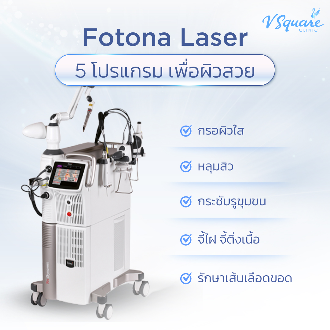 Fotona เลเซอร์กระเนื้อ