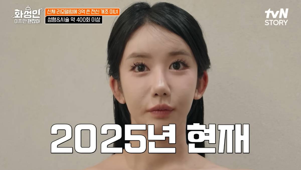 กิลอีวอน สาวเกาหลีศัลยกรรม 400 ครั้ง ปัจจุบัน 2025