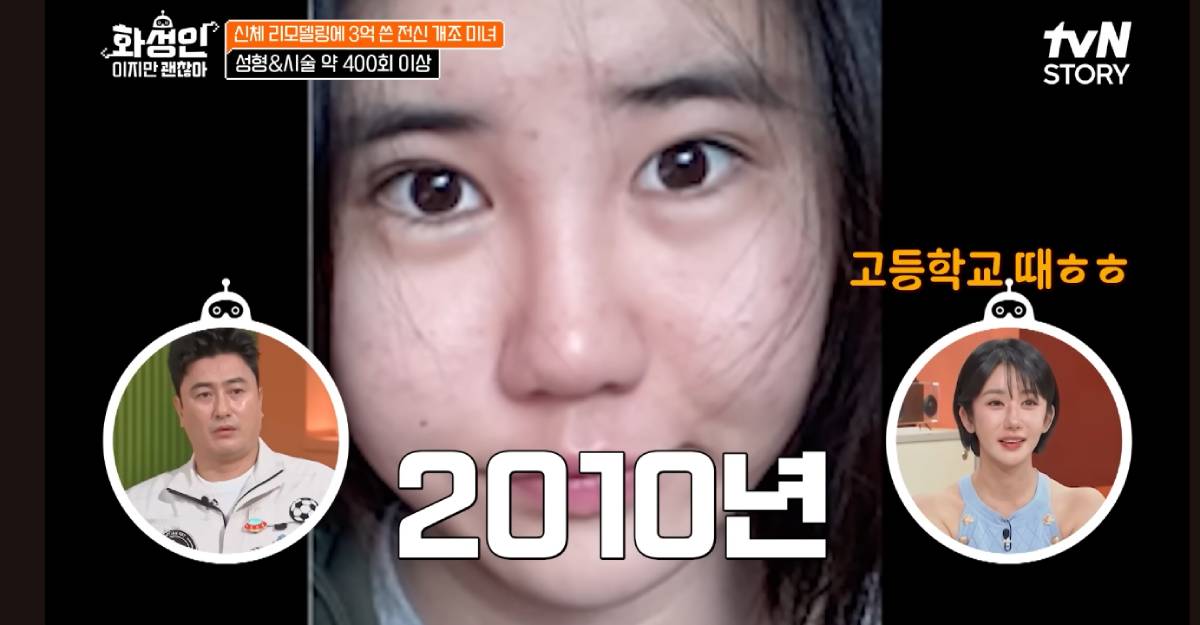 หน้าเก่า สาวเกาหลีศัลยกรรม 400 ครั้ง