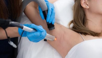 เลเซอร์ขนรักแร้ ราคาเท่าไร