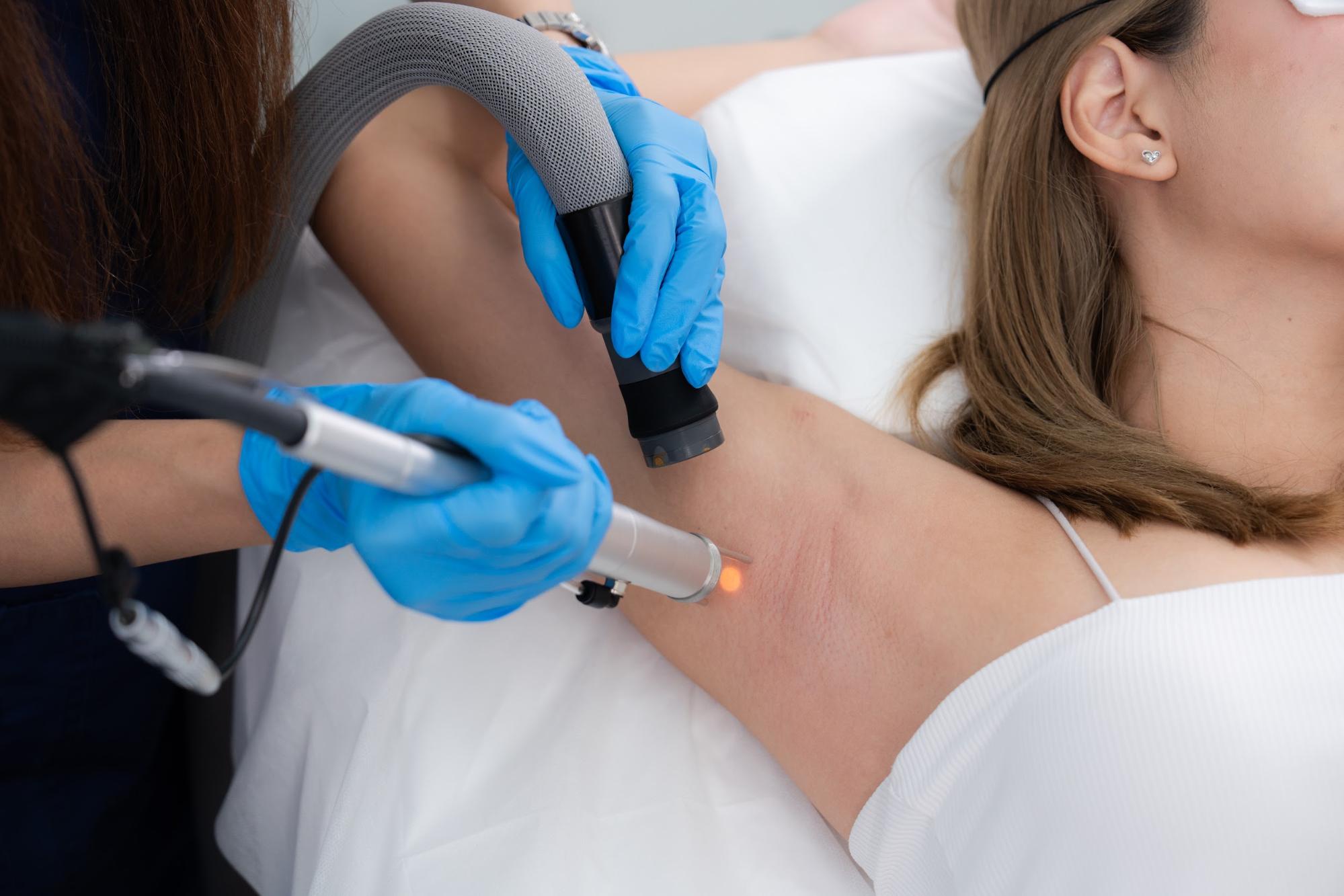 เลเซอร์ขนรักแร้ ราคาเท่าไร