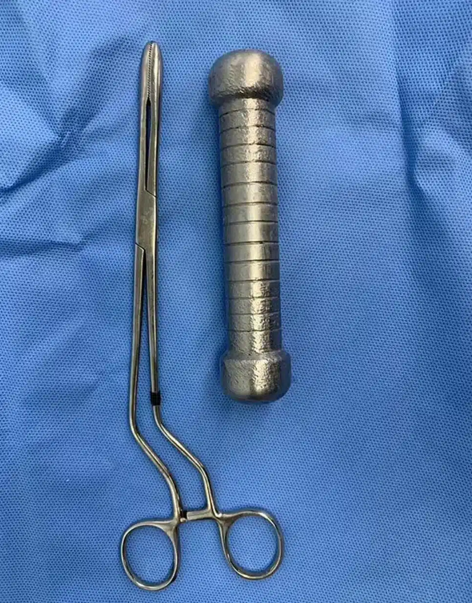 แพทย์ต้องใช้วิธีพิเศษ ใช้มือล้วงเข้าไปนำออกมา