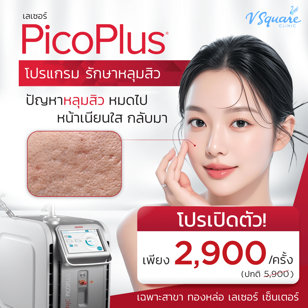 Pico Plus เลเซอร์หลุมสิว ราคา