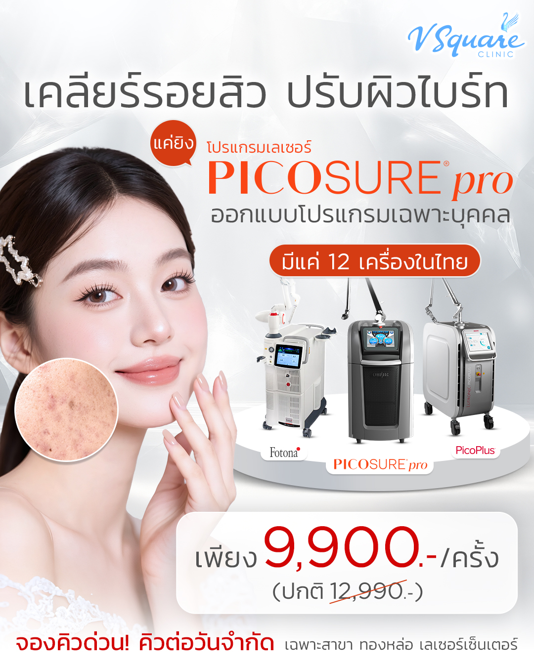 Pico Pro Sure เลเซอร์หลุมสิว ราคา