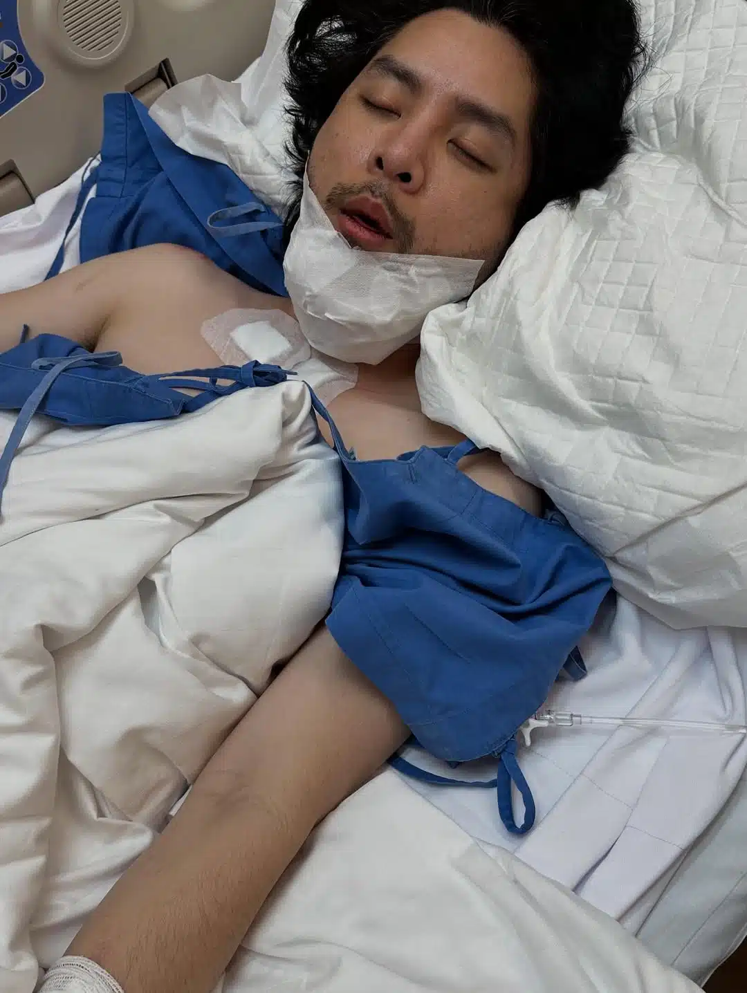 ทอม อิศราประสบอุบัติเหตุรถล้ม - 1