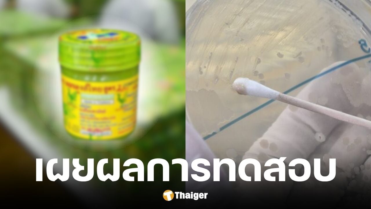 กรมวิทย์ฯ เผยผลตรวจ ยาดมสมุนไพรหงส์ไทย สูตร 2 พบเชื้อคลอสตริเดียม เพอร์ฟริงเจนส์